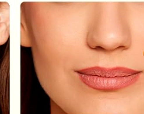 Post-acne marks after