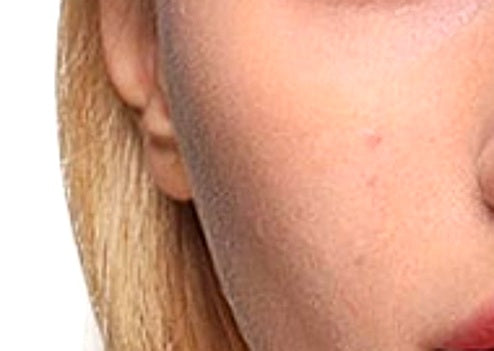 Texture before